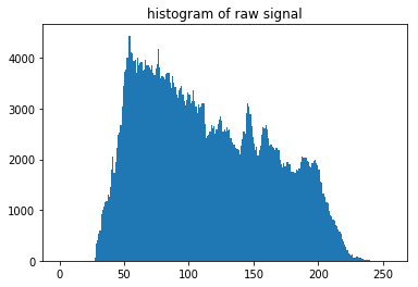 ../_images/pattern_processing_kikuchi_pattern_processing_12_0.png